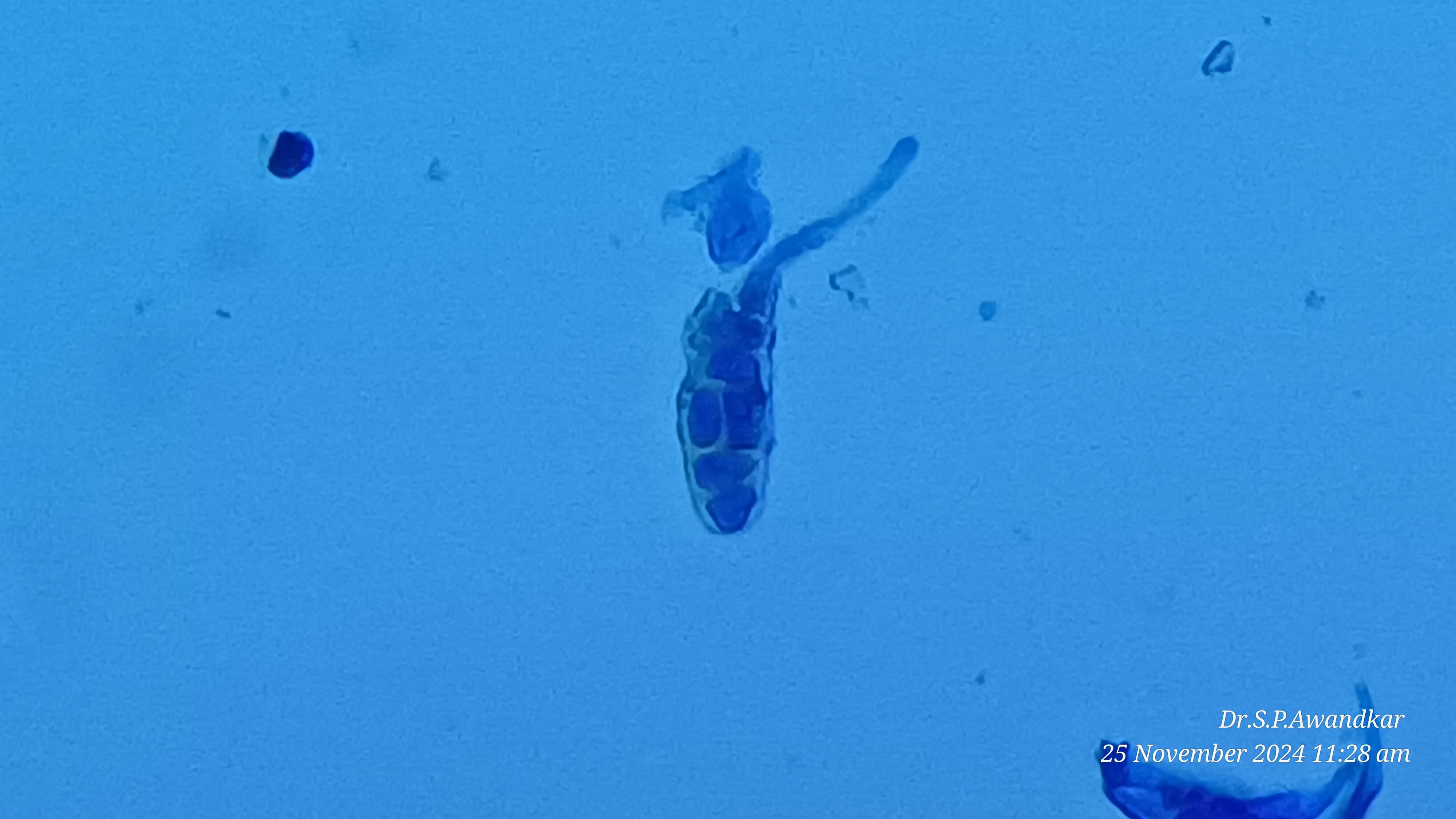 26. Alterneria Species